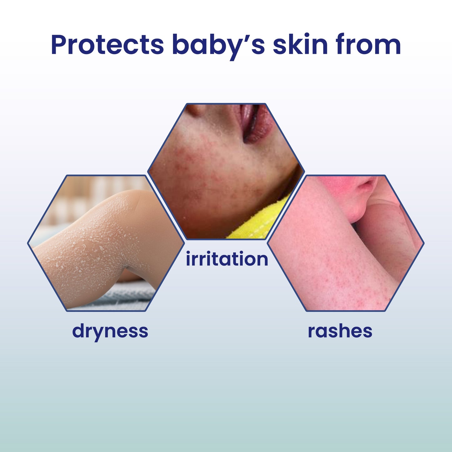 Baby Moisturizing Lotion for Soft and Hydrated Skin - Gentle Hydration for Sensitive Skin